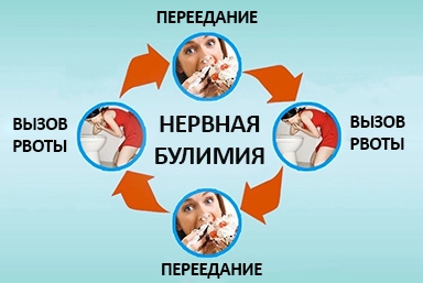 Лечение булимии в Михнево